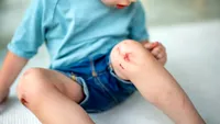 O simplă julitură se poate transforma într-o infecție periculoasă la copii. La ce trebuie să fie atenți părinții