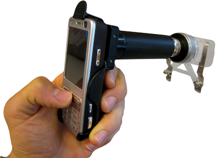 CellScope 