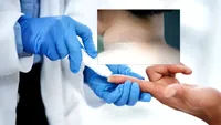 Medicii avertizează: o pată închisă la culoare pe piele poate fi un semn al diabetului de tip 2