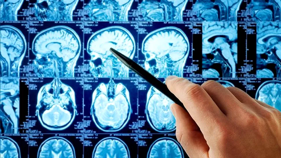 Un sistem de inteligenţă artificială a „bătut” 15 dintre cei mai buni doctori, identificând cu precizie de neegalat afecţiuni medicale grave