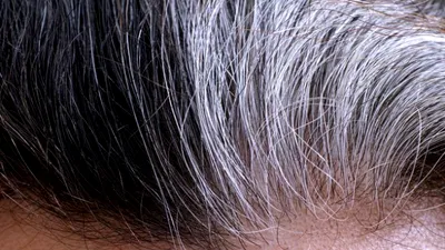 Albirea prematură a părului cauzată de stres, descifrată de oamenii de ştiinţă