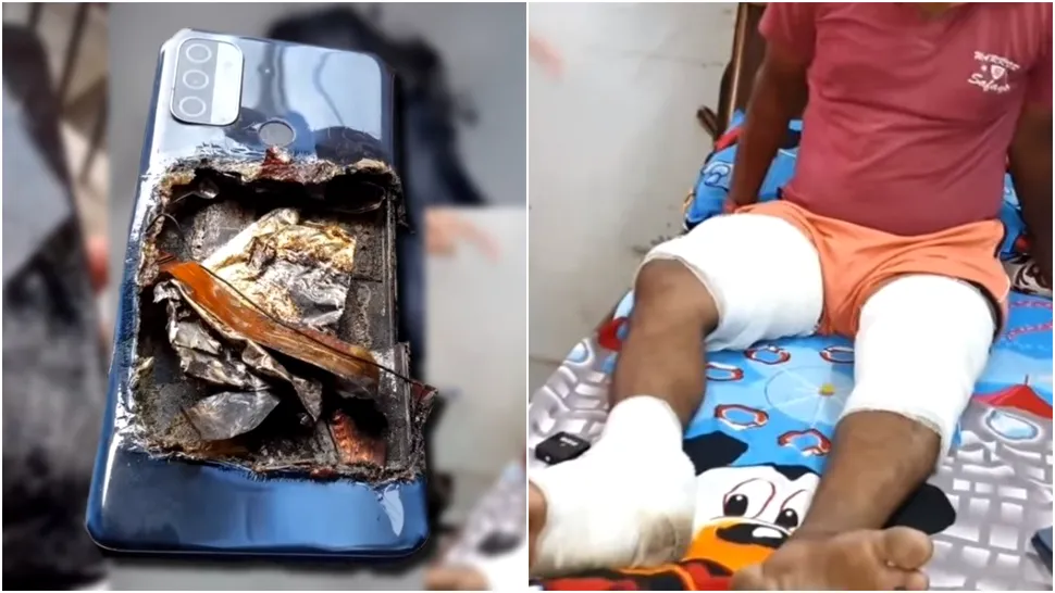 Bărbat, rănit după ce i-a explodat smartphone-ul Oppo în buzunar. Modelul, vândut și în România