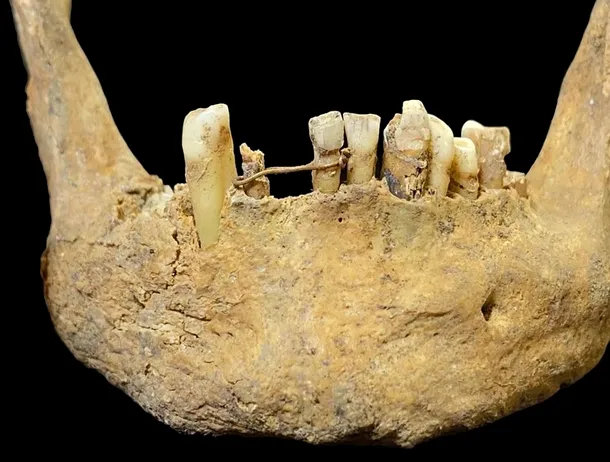 Arheologii au descoperit un schelet medieval cu ceva ciudat între dinți: o sârmă din aur de calitate superioară