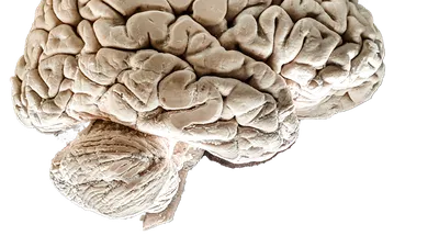 Implant pe creier care îmbunătățește cu 50% memoria, dezvoltat de o agenție din cadrul armatei americane
