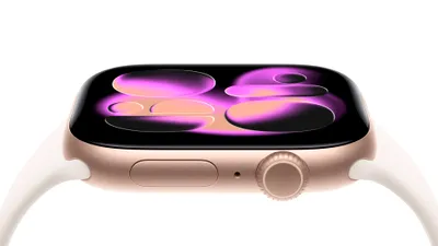 Noul Apple Watch Series 11 oferă informații importante despre sănătate