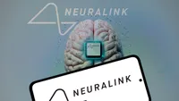 Neuralink va începe „producția la scară largă” de implanturi cerebrale și va trece la o procedură chirurgicală complet automatizată în 2026, anunță Musk