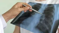 Această femeie s-a ales cu o boală nemiloasă, după ce a stat în casă în timpul pandemiei! Pericolul ascuns la care s-a expus în propria locuință