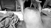 Diagnosticul pe care l-a primit o femeie de 56 de ani. Medicii s-au crucit când au văzut așa ceva: „Operația mi-ar fi fatală”