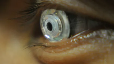 Google și Samsung se pregătesc să concureze în piața lentilelor de contact cu funcții Smart