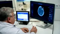 Nu mânca niciodată acest aliment dacă observi acest detaliu! Un neurolog spune că poate ascunde o toxină extrem de periculoasă
