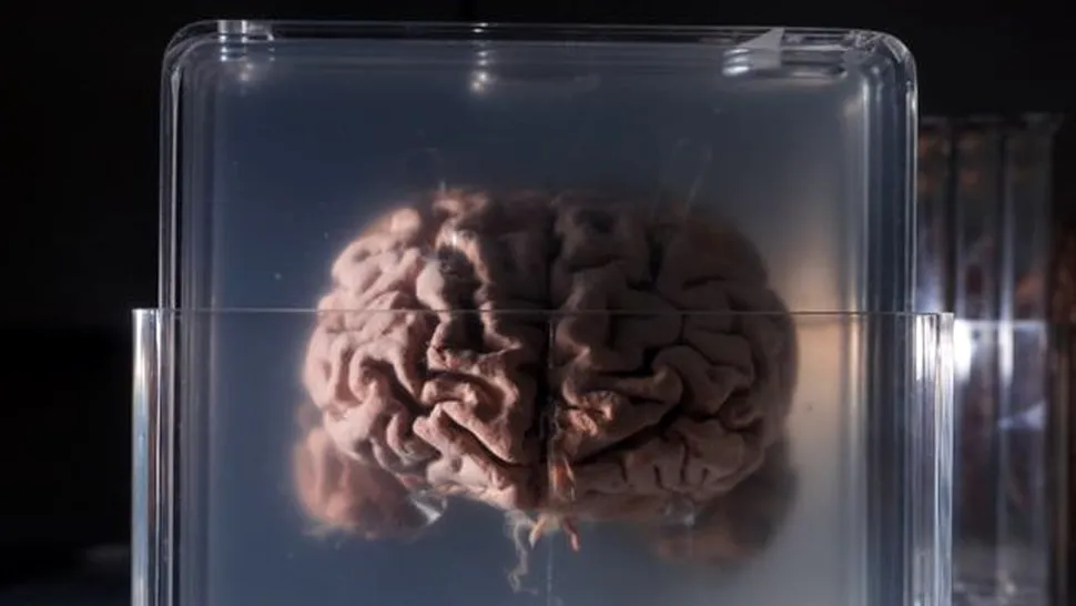 Poţi conserva un creier mort în aşa fel încât să poţi face „download” la amintirile din el mai târziu? Acest startup crede că da