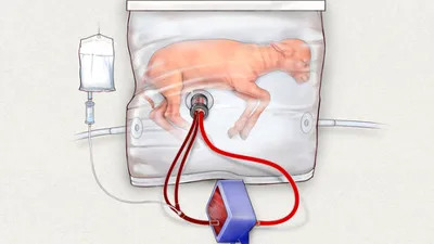 Cercetătorii au creat primul uter artificial, care ar putea salva mulţi copii născuţi înainte de termen