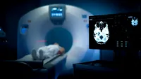 Ce au descoperit medicii când i-au făcut un CT unui bărbat în vârstă de 70 de ani