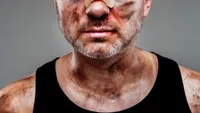BANCUL ZILEI. Bulă ajunge la Urgențe după ce e bătut zdravăn de Bubulina