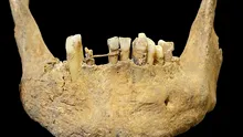 Arheologii au descoperit un schelet medieval cu ceva ciudat între dinți: o sârmă din aur de calitate superioară