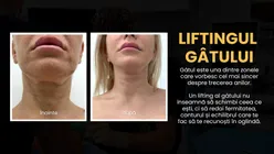 Liftingul de gât: de ce gâtul îmbătrânește primul și când devine operația estetică o opțiune (P)