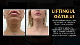 Liftingul de gât: de ce gâtul îmbătrânește primul și când devine operația estetică o opțiune (P)
