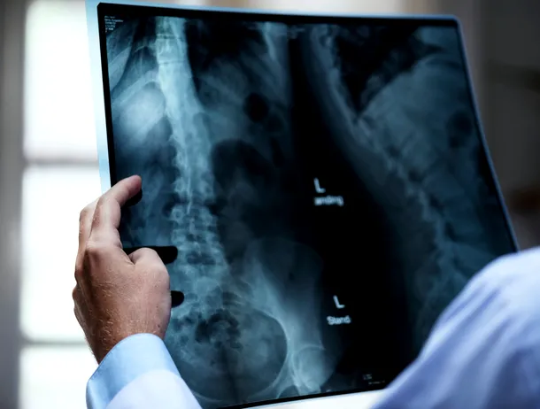 Un spital din România cumpără o soluție AI pentru interpretarea radiografiilor și CT-urilor