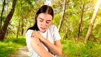 Primele minute după mușcătura de căpușă sunt cruciale. Ce trebuie să faci imediat
