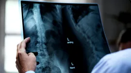 Un spital din România cumpără o soluție AI pentru interpretarea radiografiilor și CT-urilor