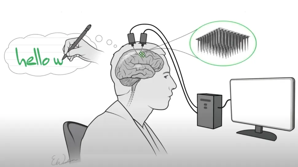 A fost creat implantul neural care poate transcrie gândurile