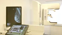 Unde fac femeile cel mai des mamografii în Europa. Ce arată datele despre România
