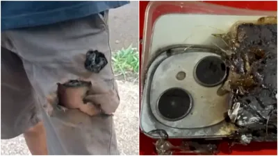 Bărbat atacat de câini, salvat în mod neașteptat de explozia telefonului din buzunar. Bateria, perforată de colții animalelor