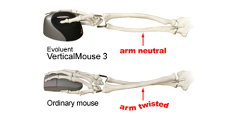 Mouse vertical