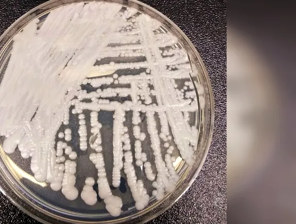 Ciuperca Candida auris este acum endemică în cinci state din Europa, inclusiv România. Poate fi ținută sub control?