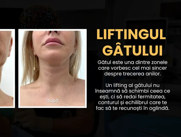 Liftingul de gât: de ce gâtul îmbătrânește primul și când devine operația estetică o opțiune (P)