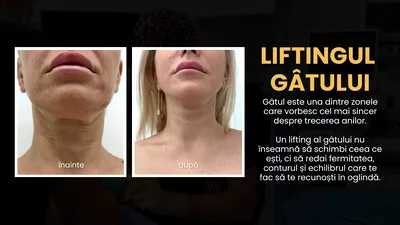 Liftingul de gât: de ce gâtul îmbătrânește primul și când devine operația estetică o opțiune (P)