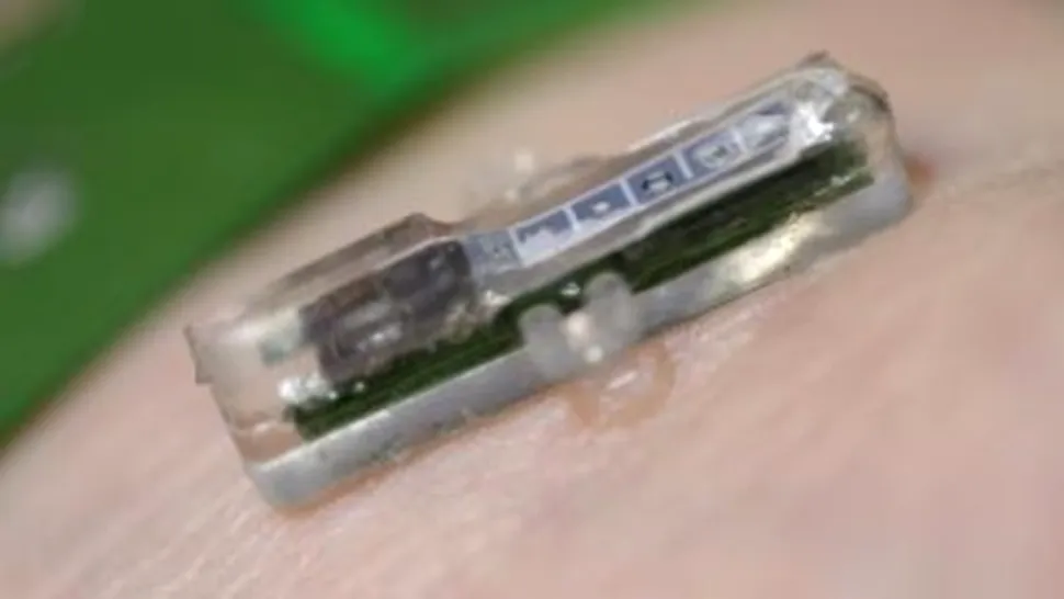 Implant wireless cât un plasture, detectează cu ore înainte iminenţa unui infarct